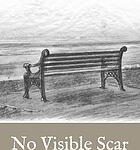 NO VISIBLE SCAR